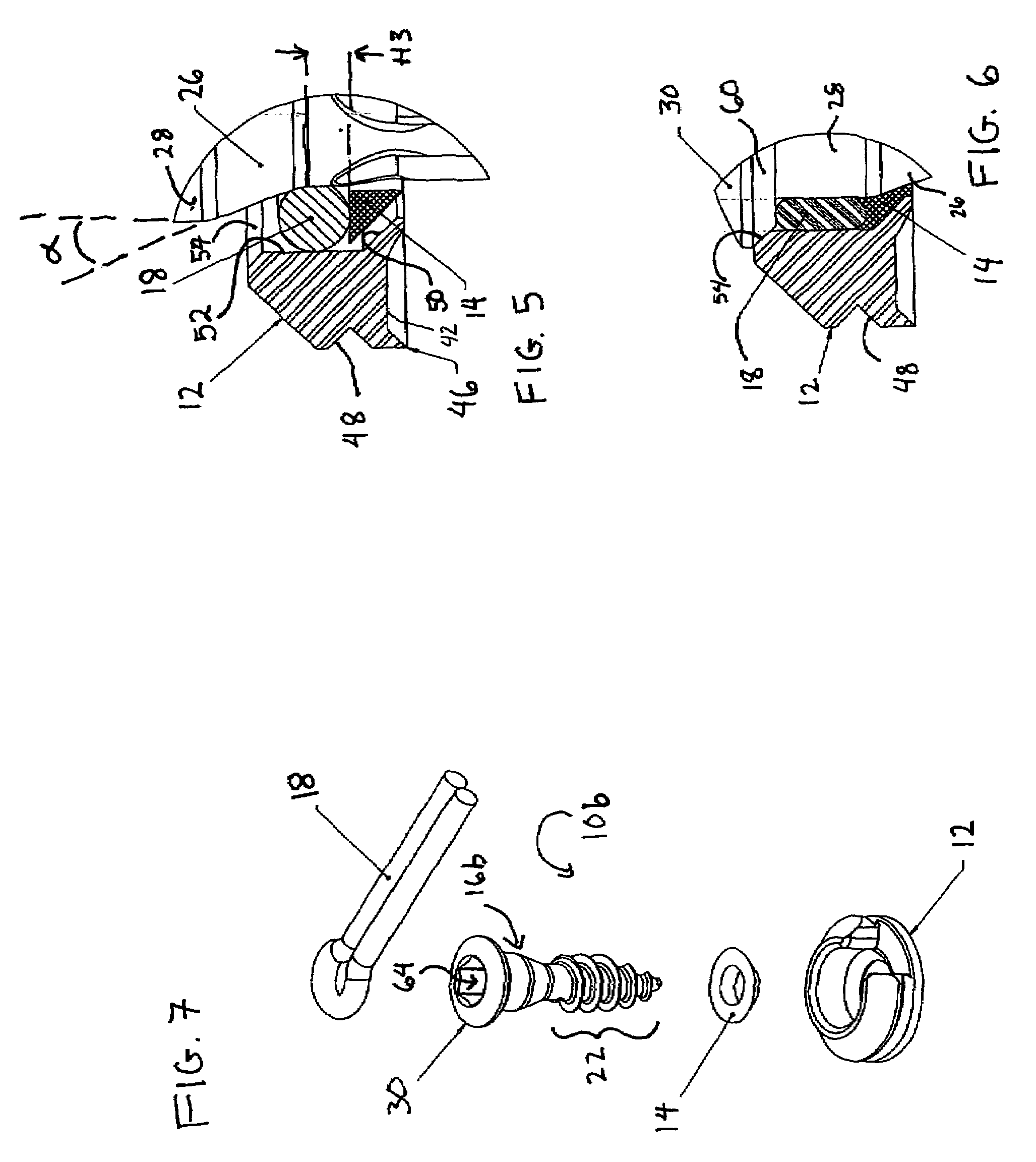 Cable anchor for attaching elastic cable to a bony substrate