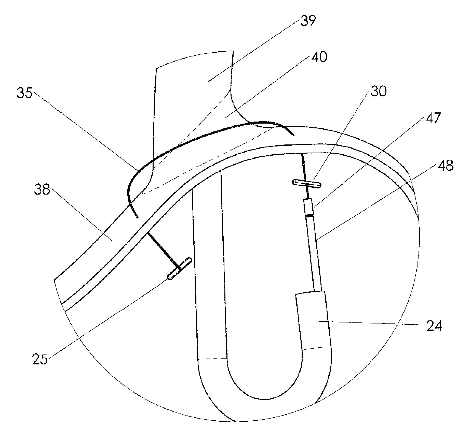 Methods and devices for endoscopic treatment of organs