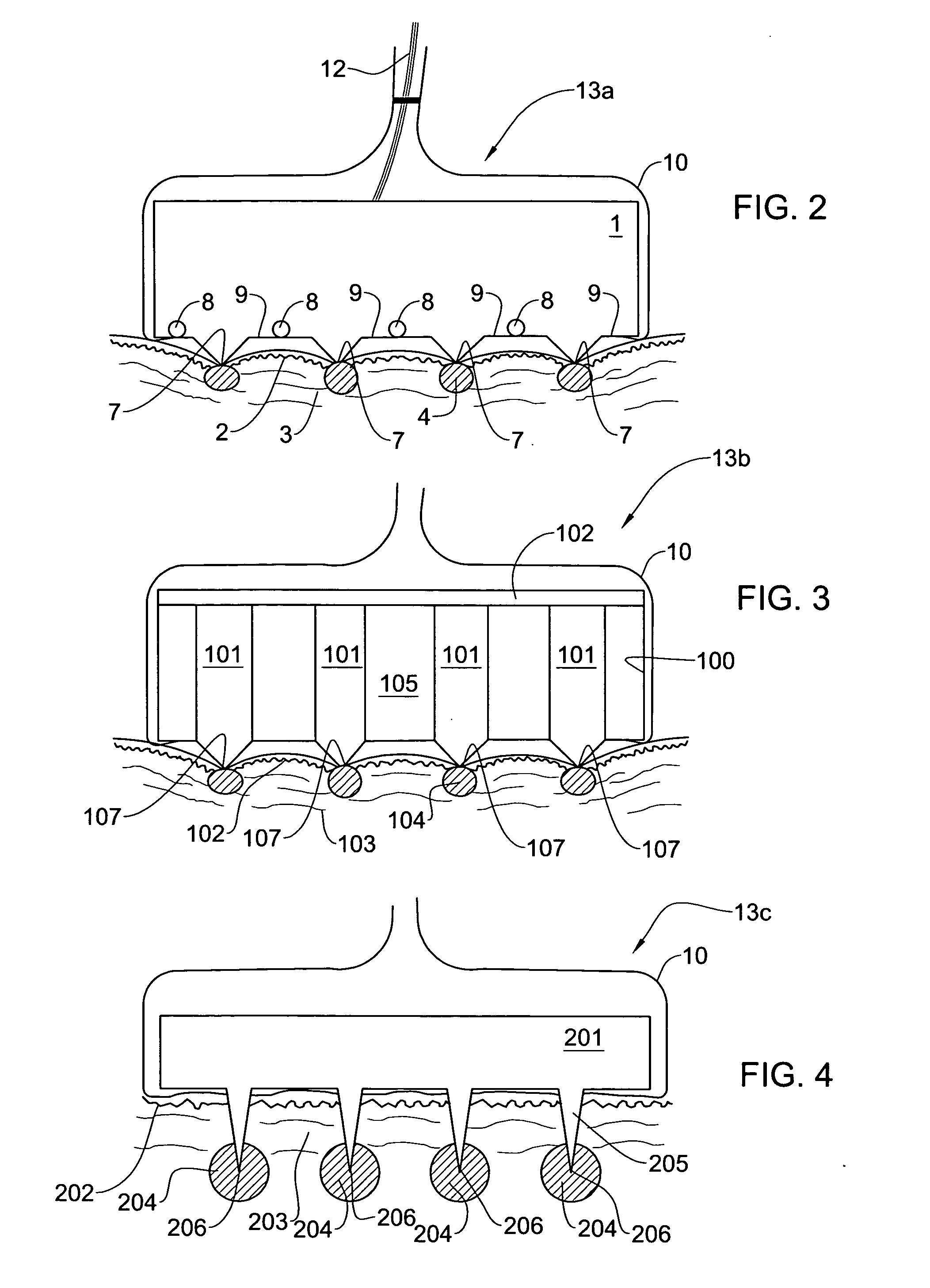 Method and system for invasive skin treatment