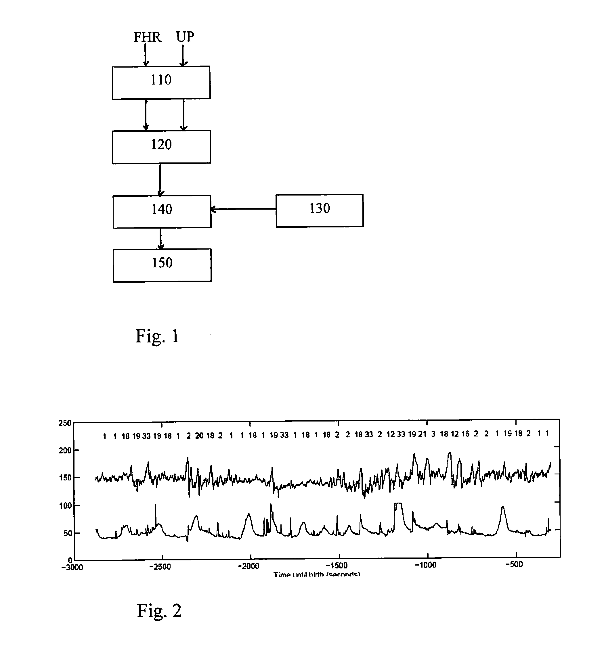 Apparatus and method for feature extraction and classification of fetal heart rate