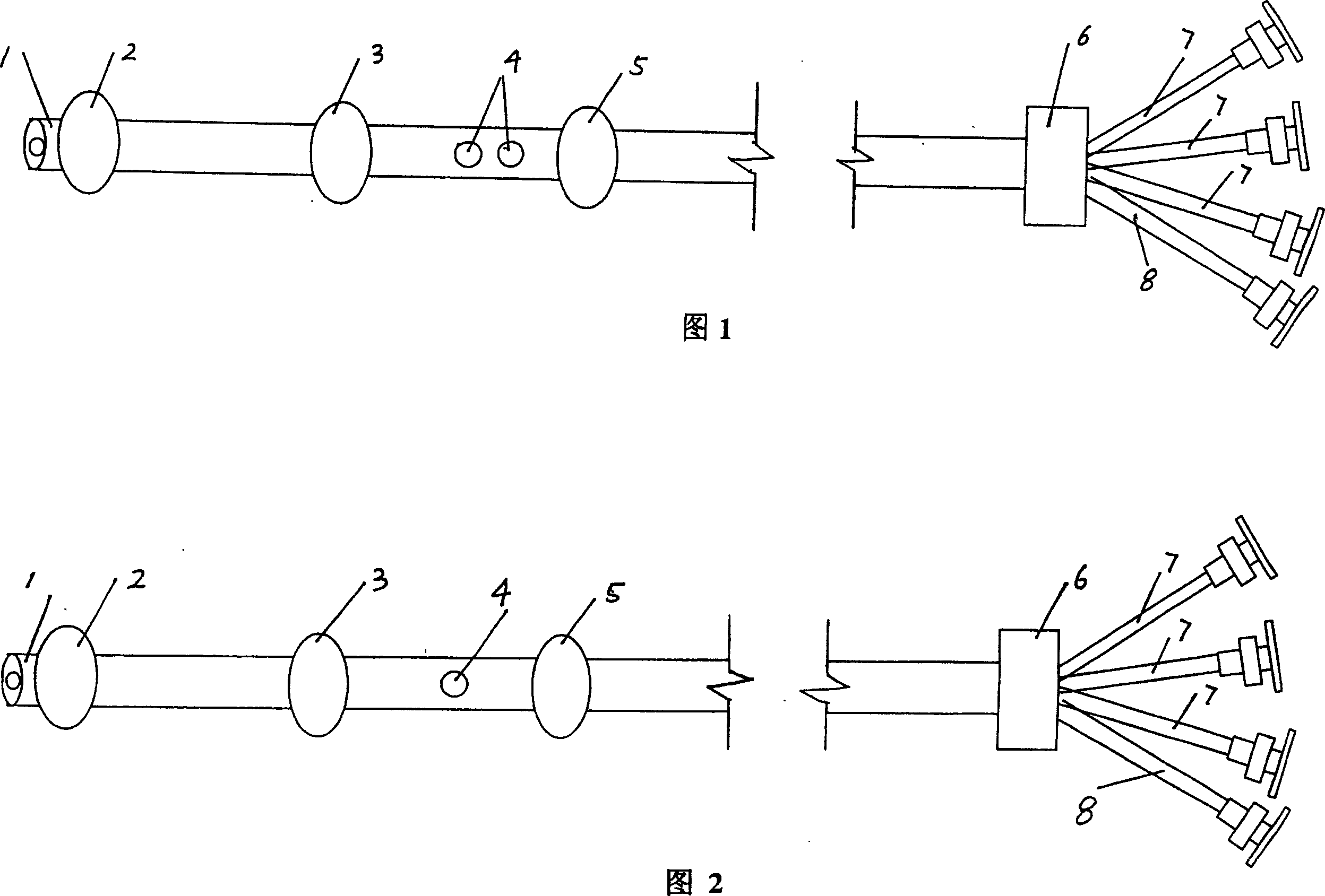 Multi saccule catheter in blood vessel