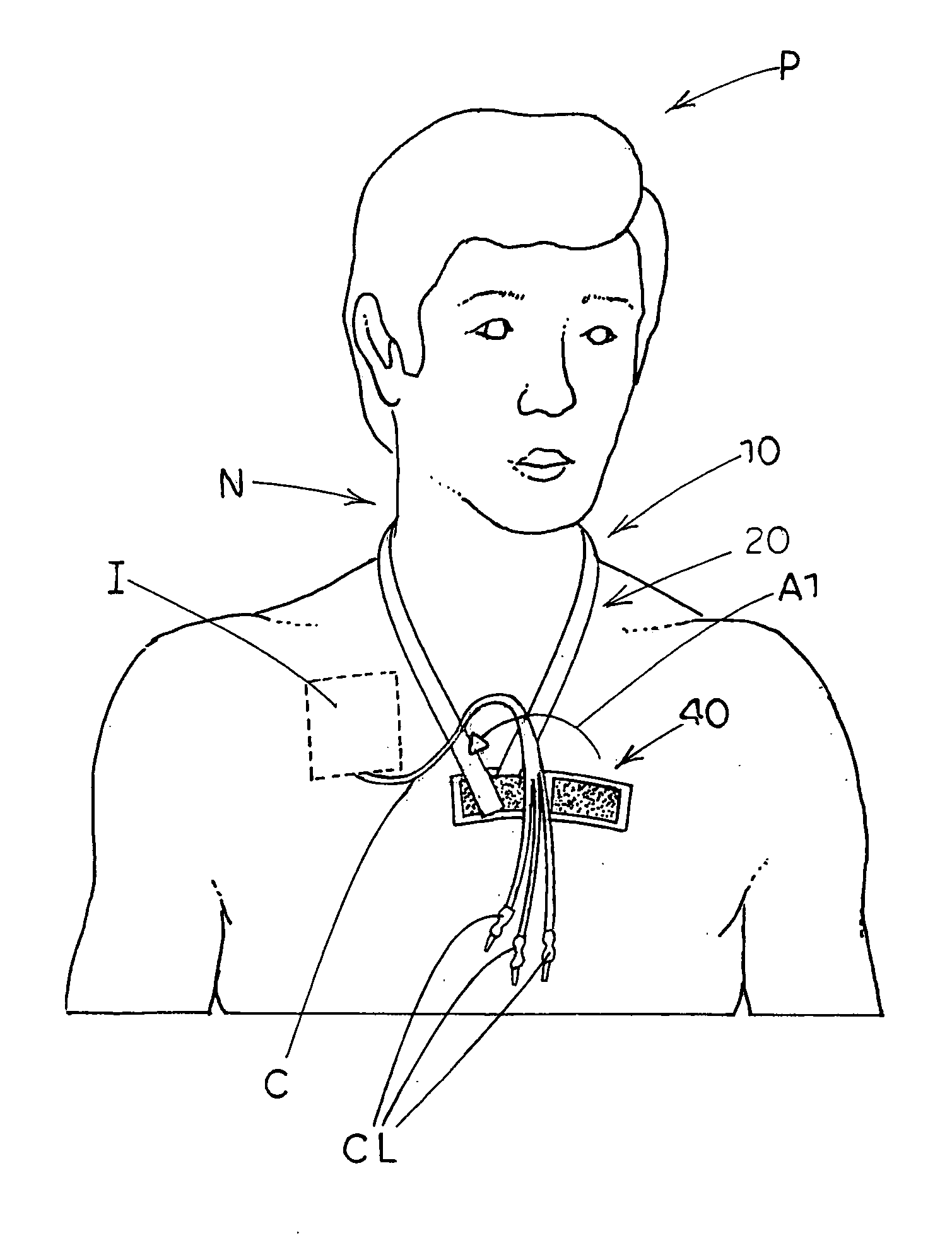 Catheter support apparatus and method