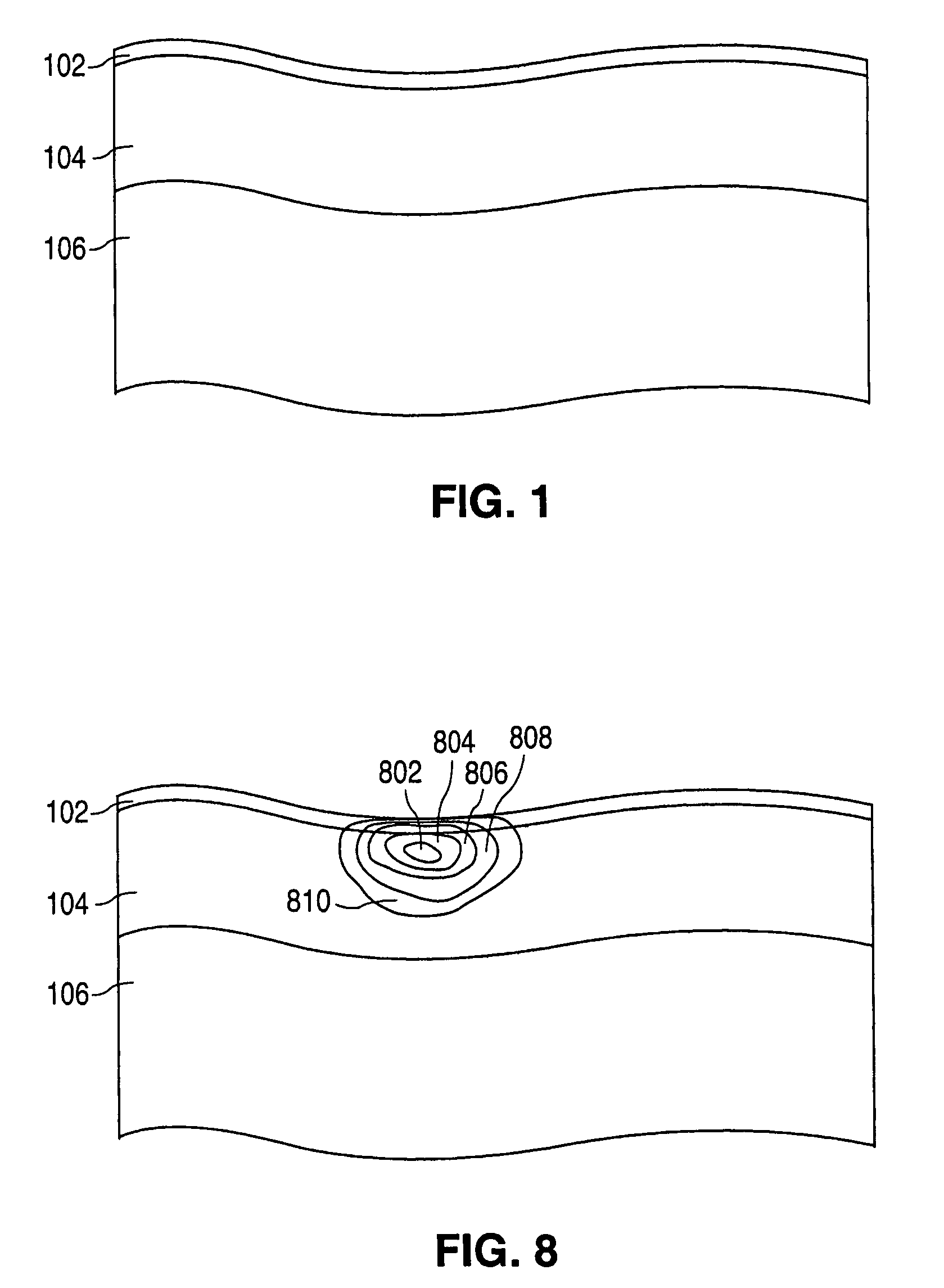 Method for treatment of post-partum abdominal skin redundancy or laxity