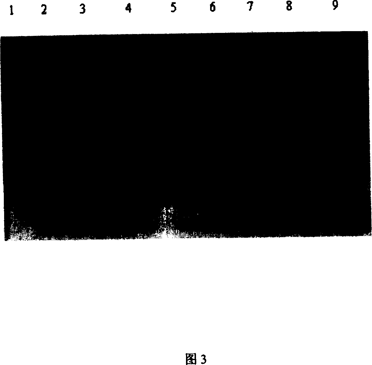 Interfusion protein of antineoplastic genetic engineering composed of target short peptide of receptor of epidermal growth factor and Lidamycin