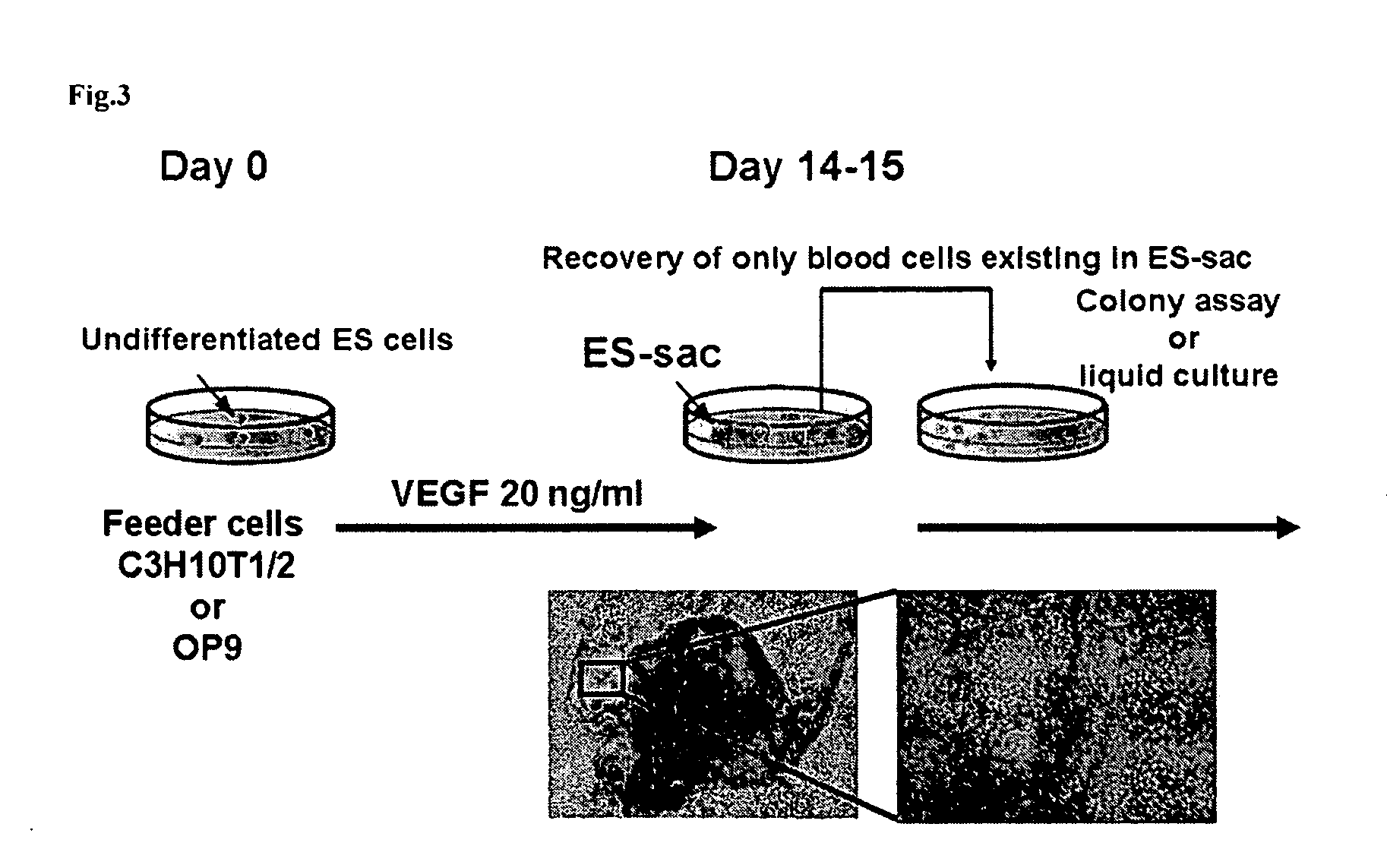 Structure enclosing hematopoietic progenitor cells from ES cells and method for preparing blood cells using the same