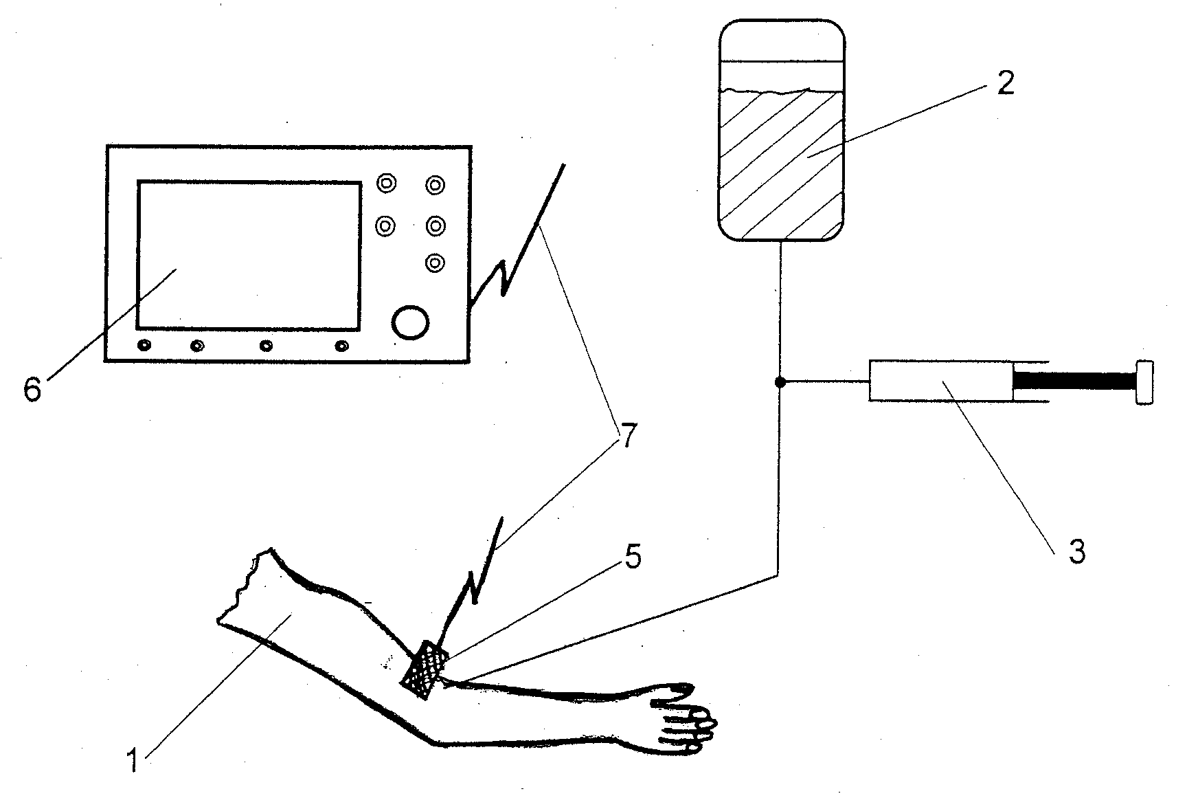 Method and device for monitoring infusions