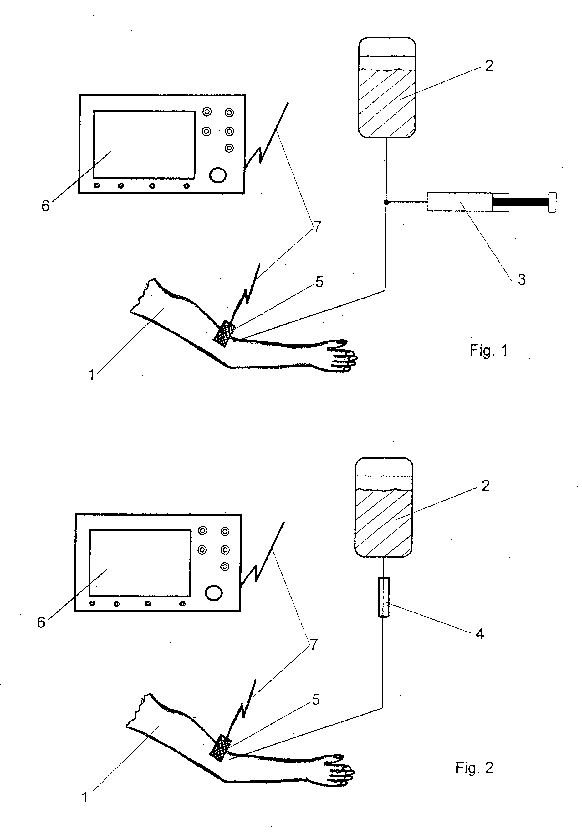 Method and device for monitoring infusions