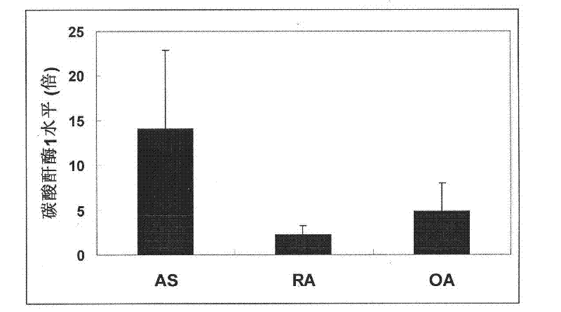 Application of methazolamide in preparing medicament for treating ankylosing spondylitis