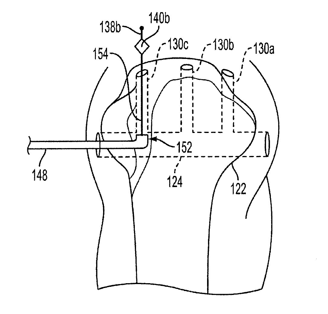 Methods and Devices for Forming Bone Tunnels