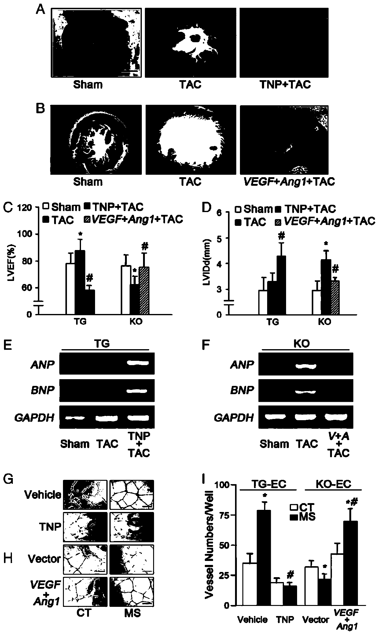 Adenovirus vector and application thereof in preparation of medicine for preventing and treating heart failure