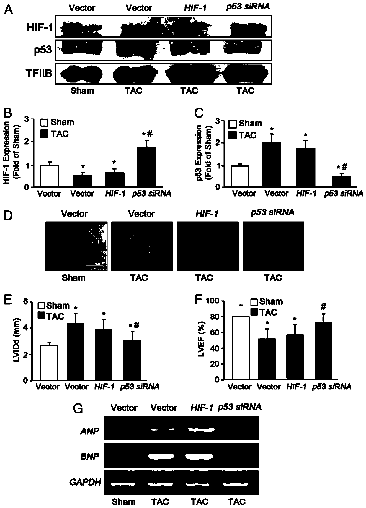 Adenovirus vector and application thereof in preparation of medicine for preventing and treating heart failure