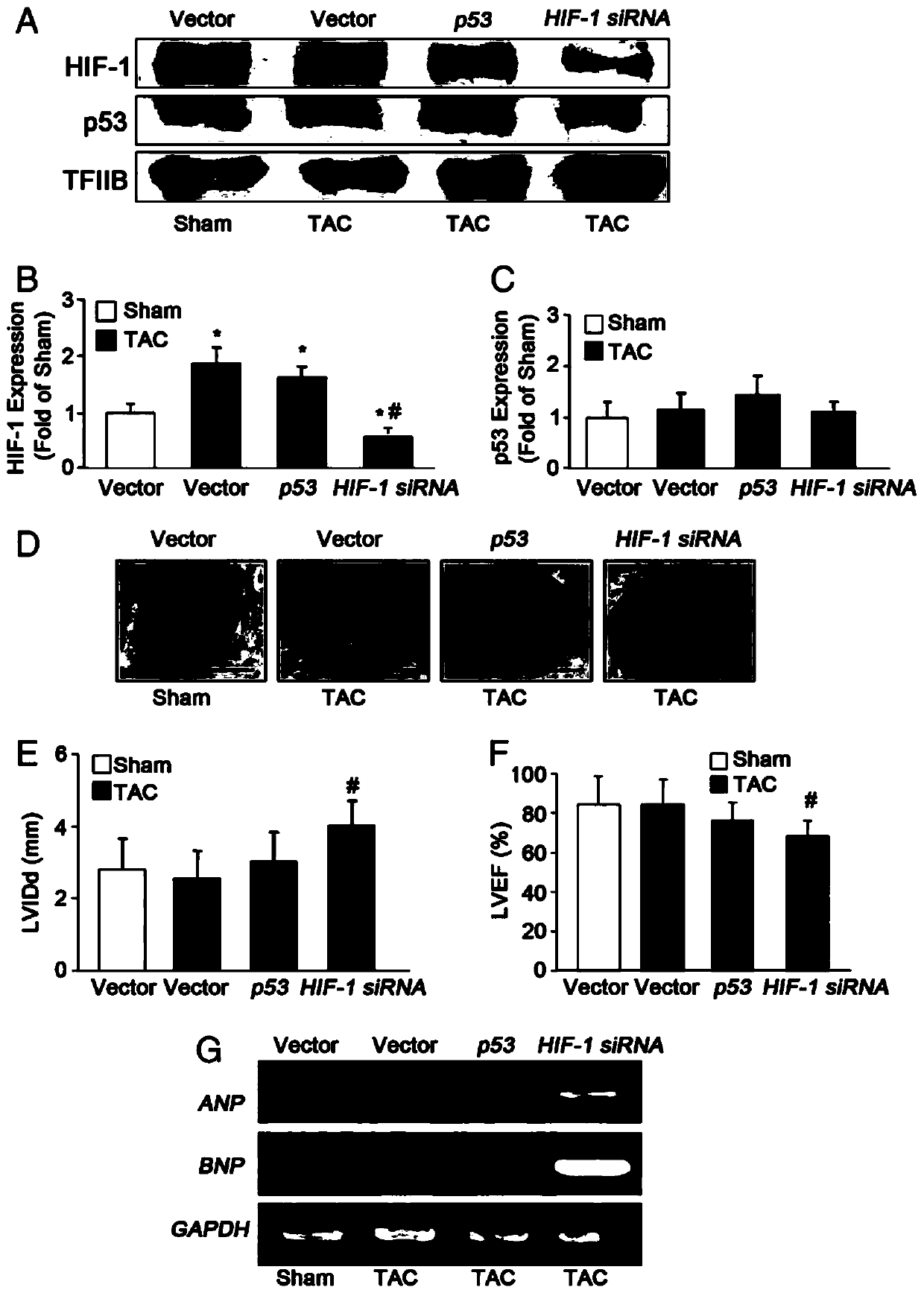 Adenovirus vector and application thereof in preparation of medicine for preventing and treating heart failure