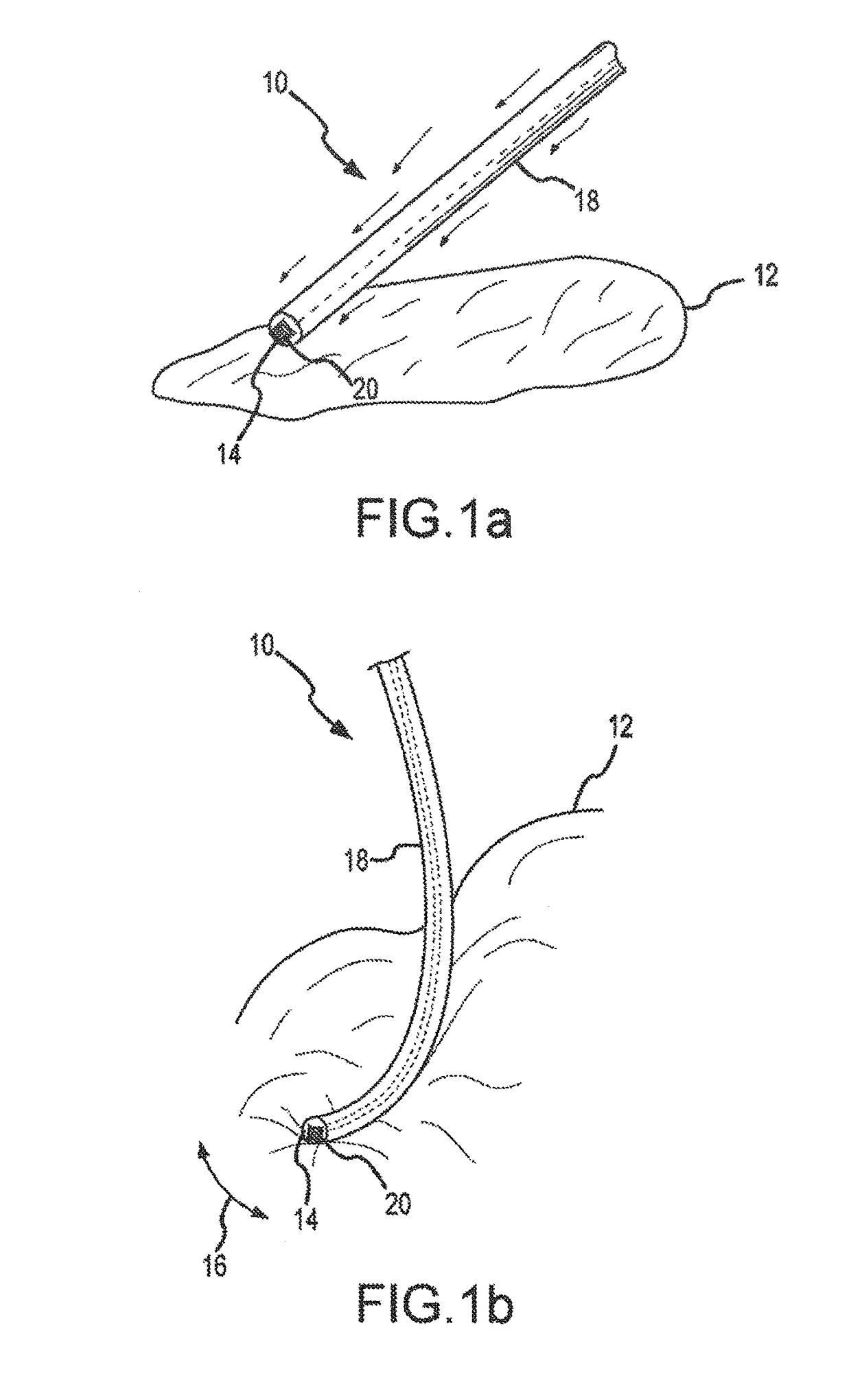 Acoustic coupling for assessment and ablation procedures