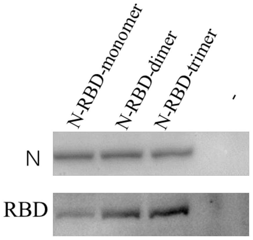 Fused gene, fused protein, recombinant vector and general DC vaccine of coronavirus and preparation methods for fused gene, fused protein, recombinant vector and general DC vaccine of coronavirus
