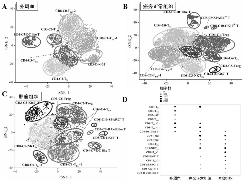 Bladder cancer depleted NKT cell subset, characteristic gene and application thereof