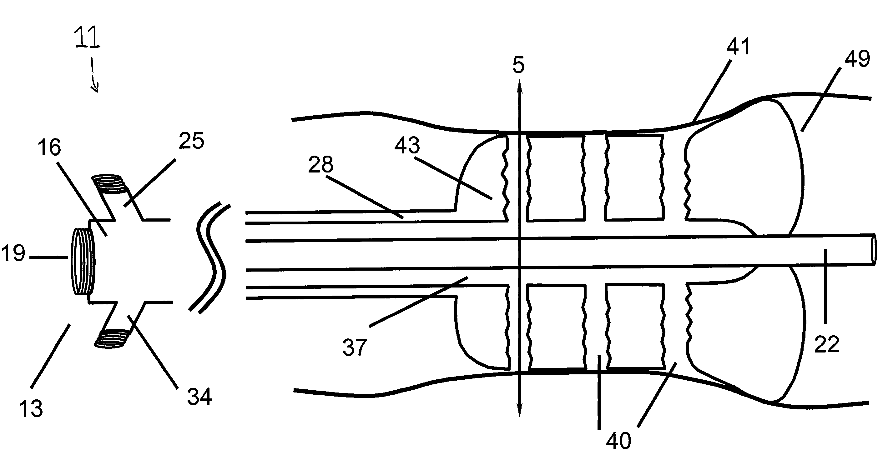 Angioplasty device with embolic recapture mechanism for treatment of occlusive vascular diseases