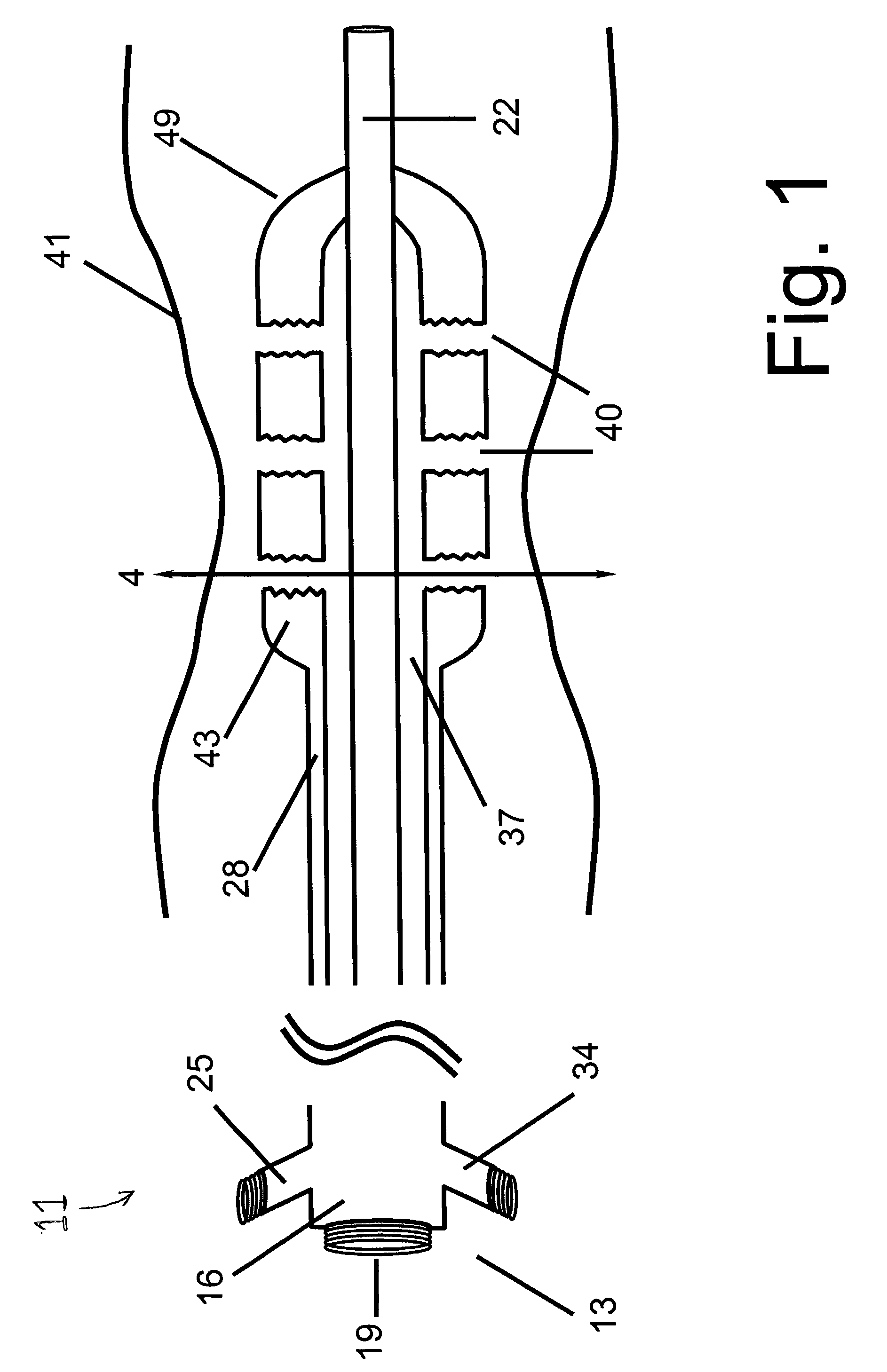 Angioplasty device with embolic recapture mechanism for treatment of occlusive vascular diseases