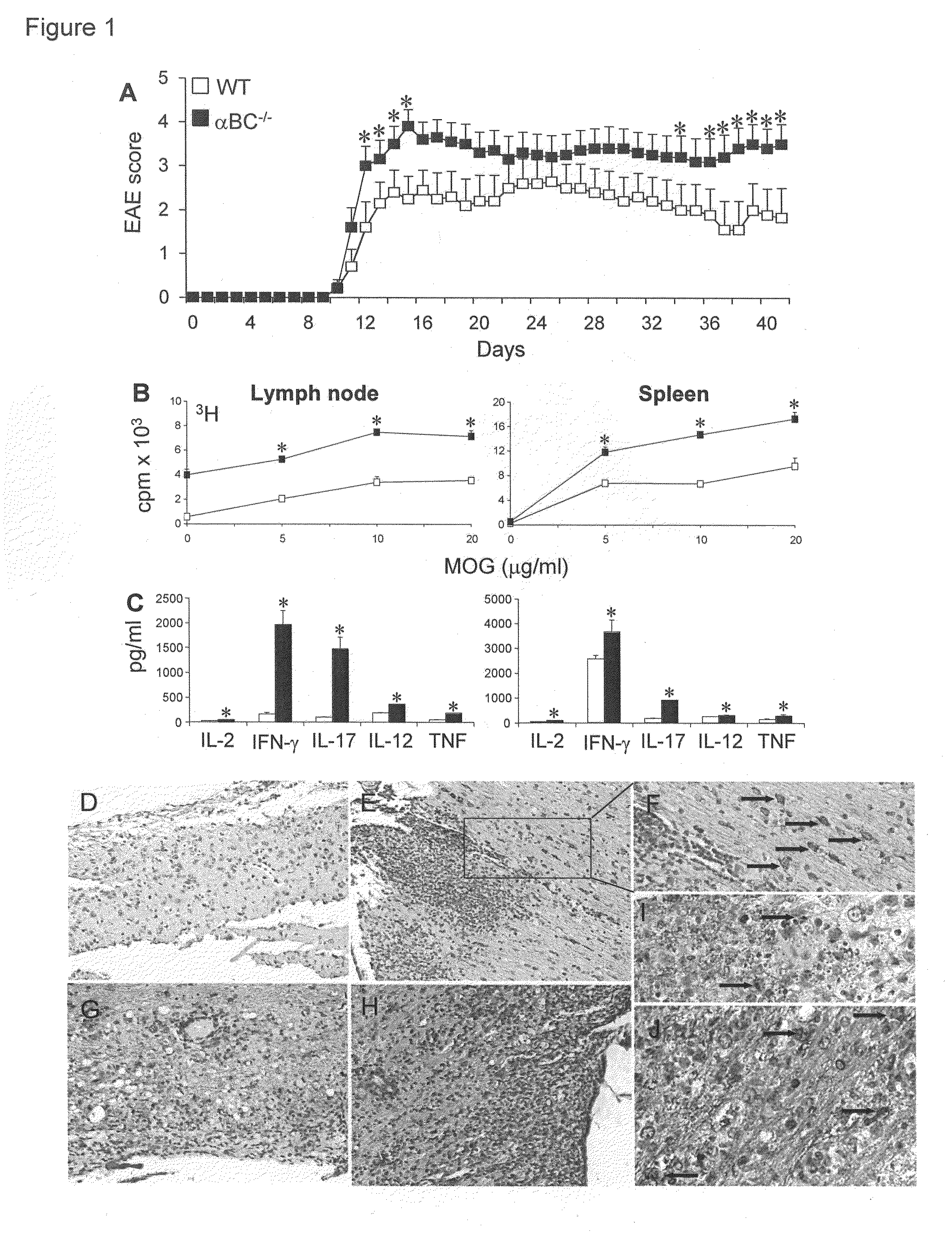 Alpha B-crystallin as a therapy for rheumatoid arthritis