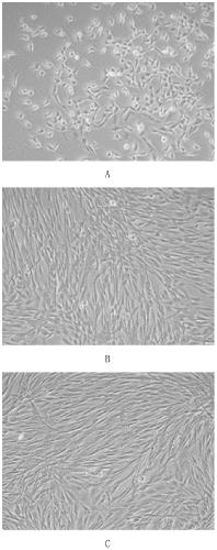 A kind of periodontal ligament stem cell adipogenic differentiation induction solution and method