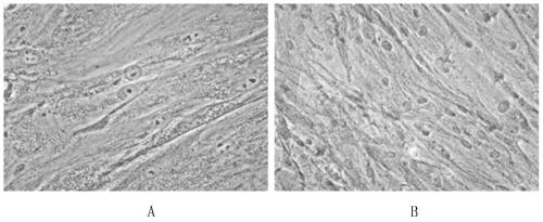 A kind of periodontal ligament stem cell adipogenic differentiation induction solution and method