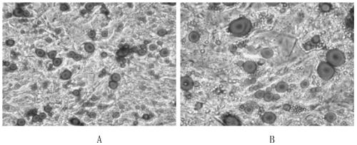 A kind of periodontal ligament stem cell adipogenic differentiation induction solution and method