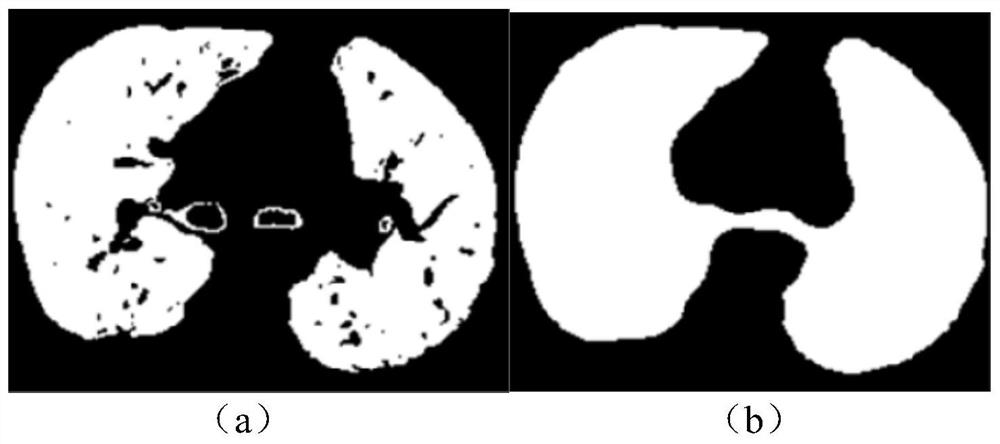 Pulmonary artery blood vessel tree obtaining method and device, storage medium and electronic equipment