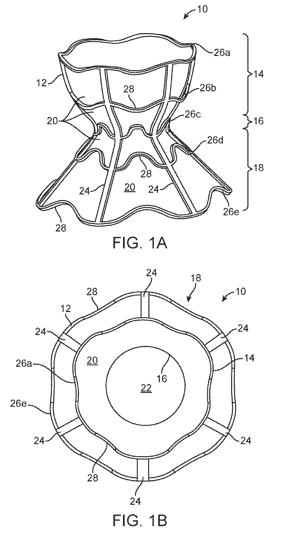 Shunt for redistributing atrial blood volume