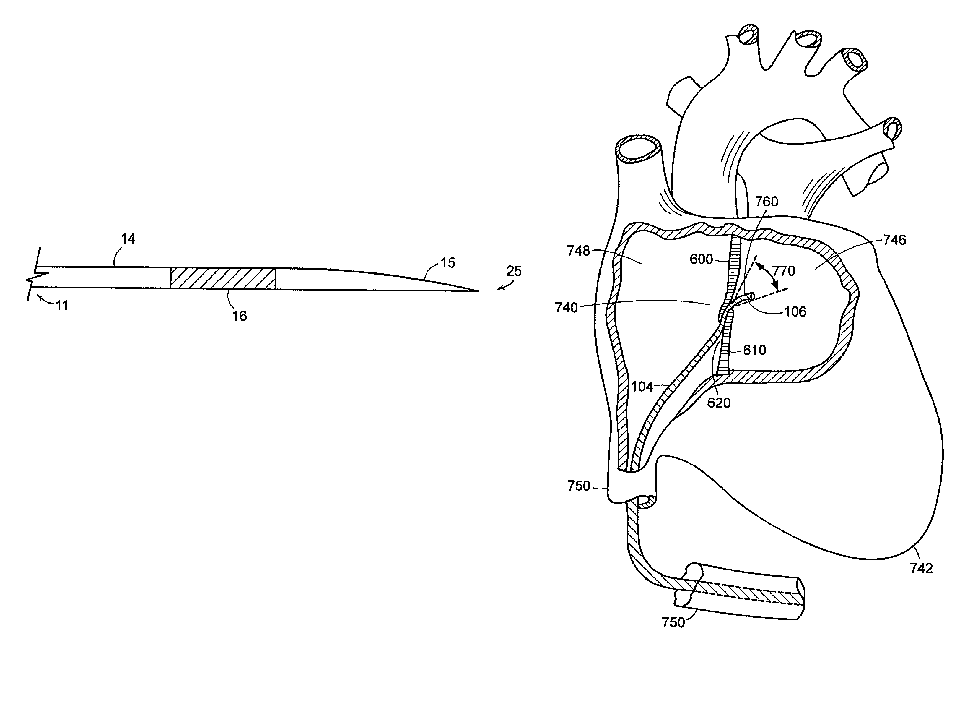 Transseptal puncture apparatus