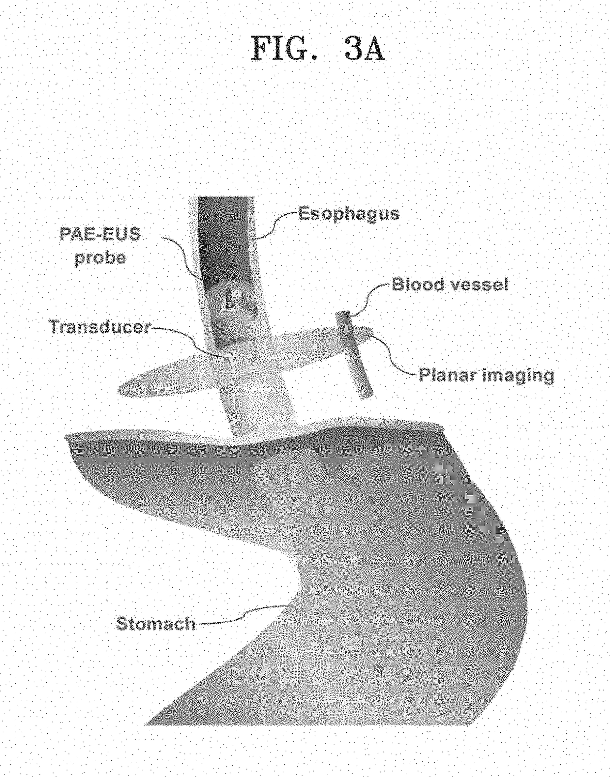 Radial array transducer-based photoacoustic and ultrasonic endoscopy system