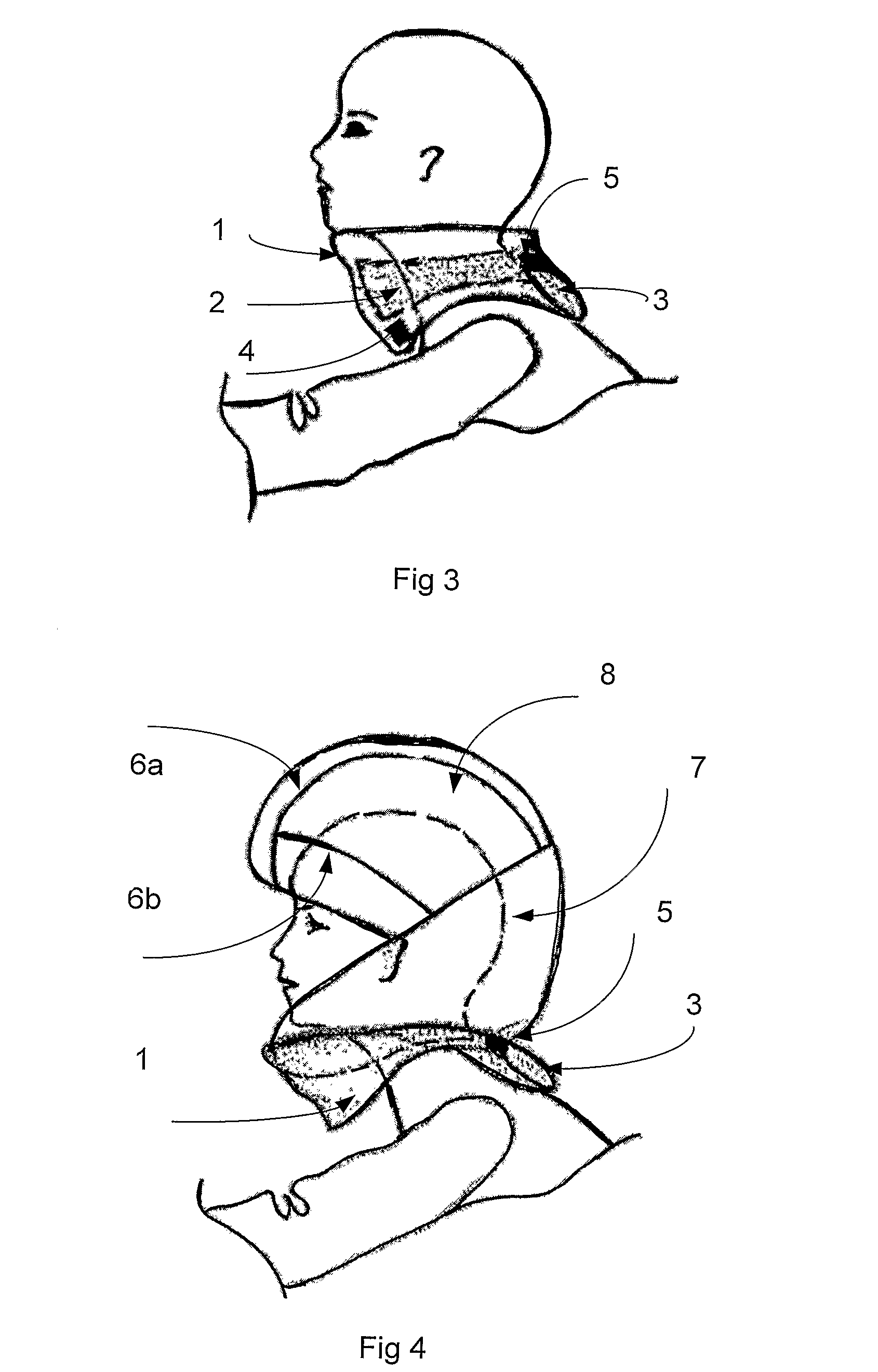 System and method for protecting a bodypart