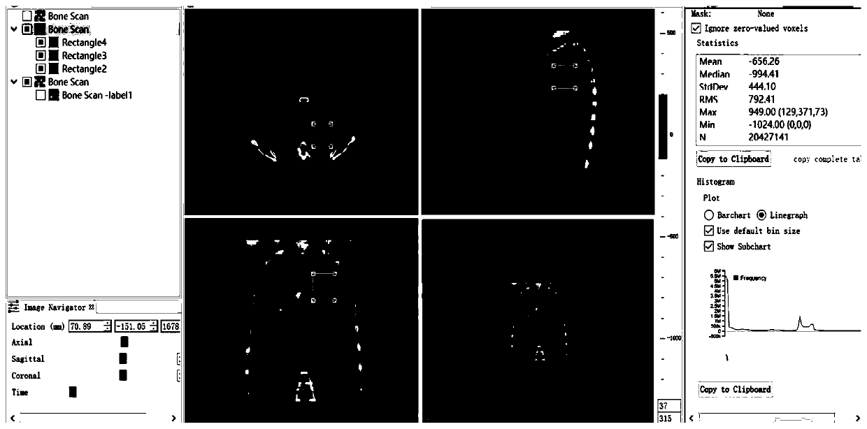 Method and system for searching images by images applied to medical image auxiliary diagnosis analysis