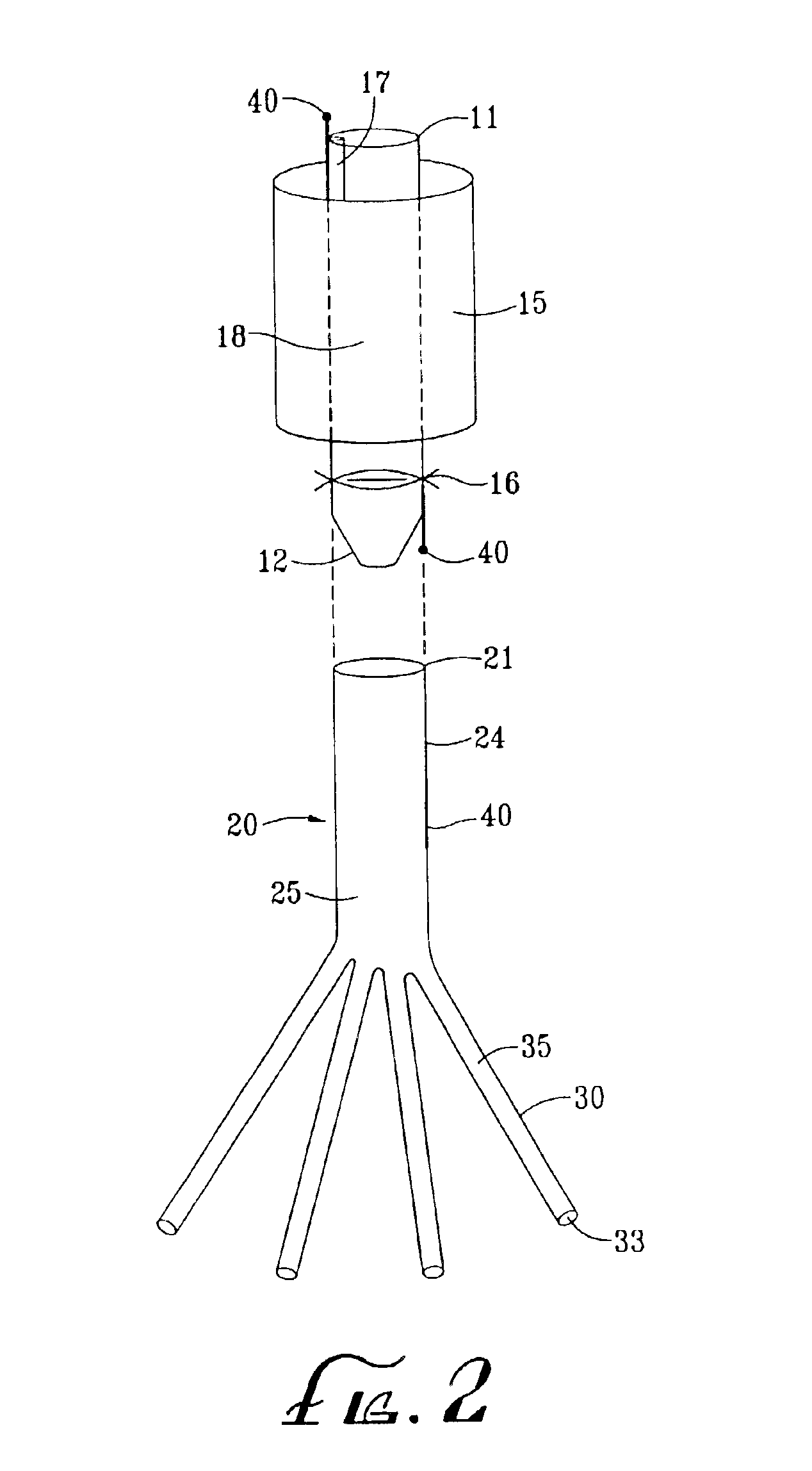 Aortic shunt with spinal perfusion and cooling device