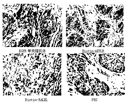 Targeted peptide of epidermal growth factor receptor (EGFR) and application thereof