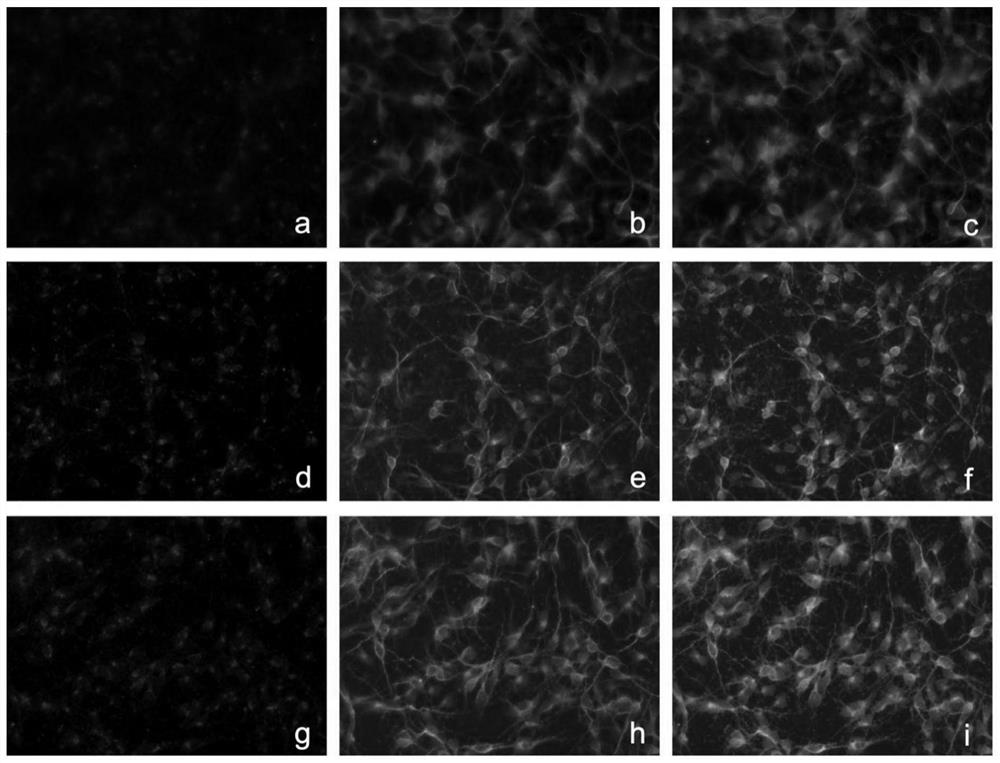 Chemical induction method of cortex neurons, and culture medium