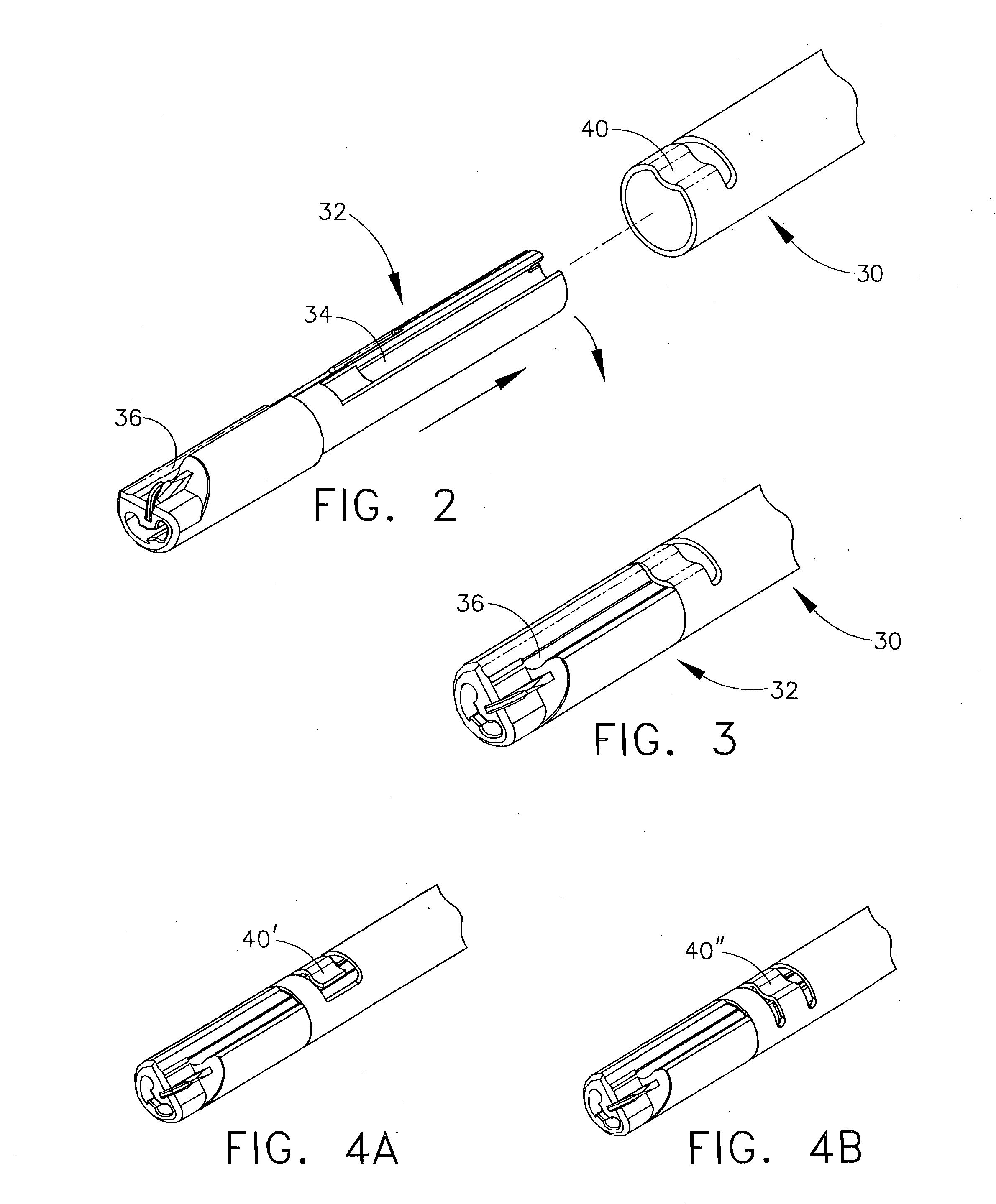 Reloadable laparoscopic fastener deploying device for use in a gastric volume reduction procedure