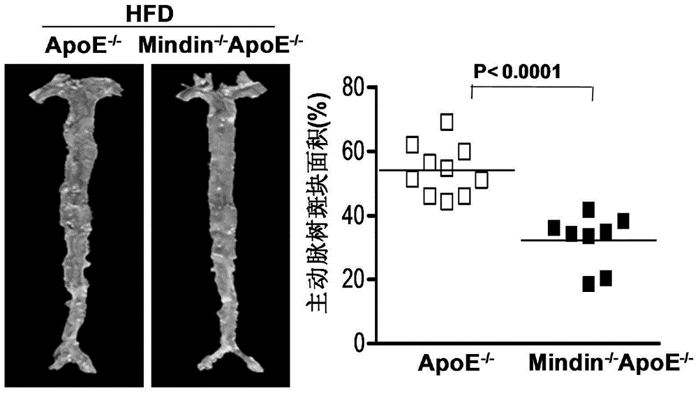 Application of mindin gene in the treatment of atherosclerosis