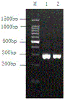 PCR (polymerase chain reaction) amplification kit for detecting metacercaria of Cs (clonorchis sinensis) on basis of ribosomal DNA (deoxyribose nucleic acid) ITS2 (internal transcribed spacer 2) and amplification primer