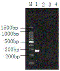 PCR (polymerase chain reaction) amplification kit for detecting metacercaria of Cs (clonorchis sinensis) on basis of ribosomal DNA (deoxyribose nucleic acid) ITS2 (internal transcribed spacer 2) and amplification primer