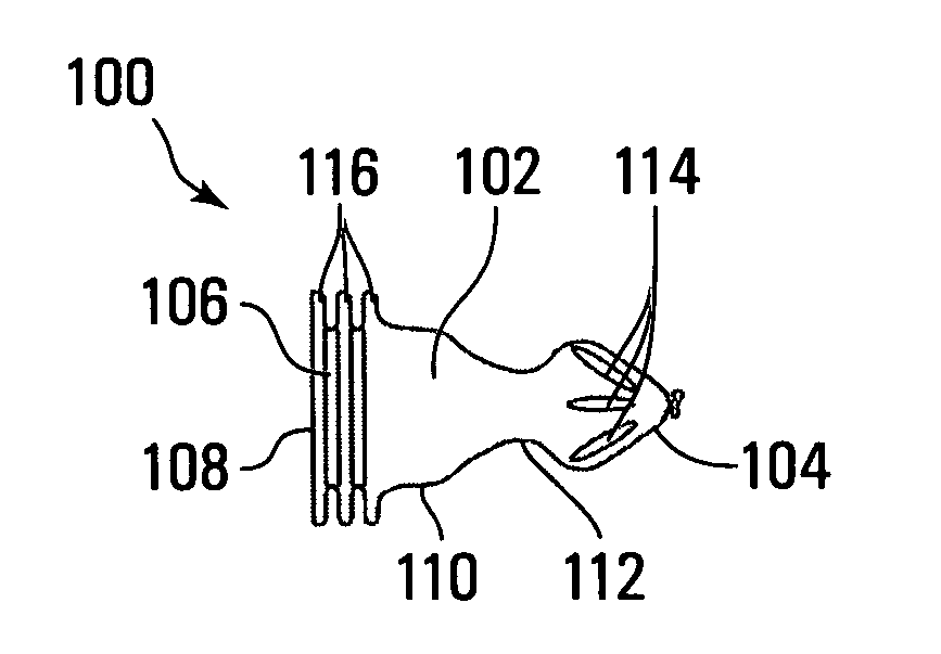 External penile prosthesis, combination of prosthesis and loose-fitting condom, and method of using condom