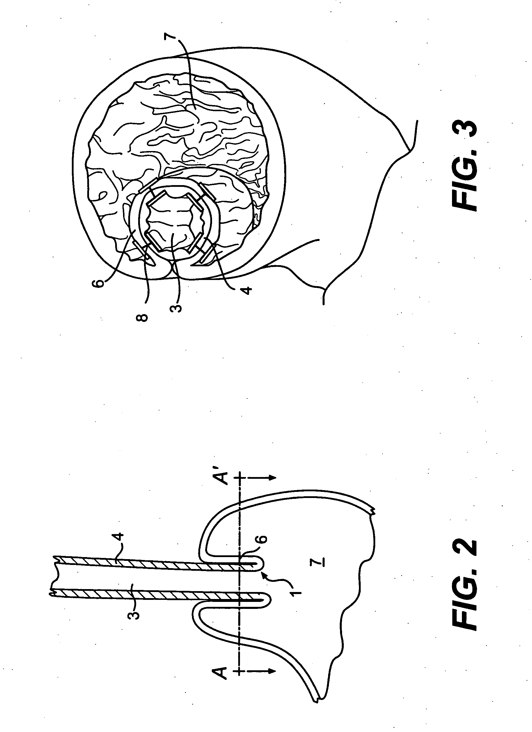Devices and methods for tissue invagination