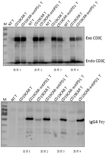 CAR-T cell specifically targeting CD19 antigen and stably expressing PD-1 antibodies at high levels as well as application of CAR-T cell