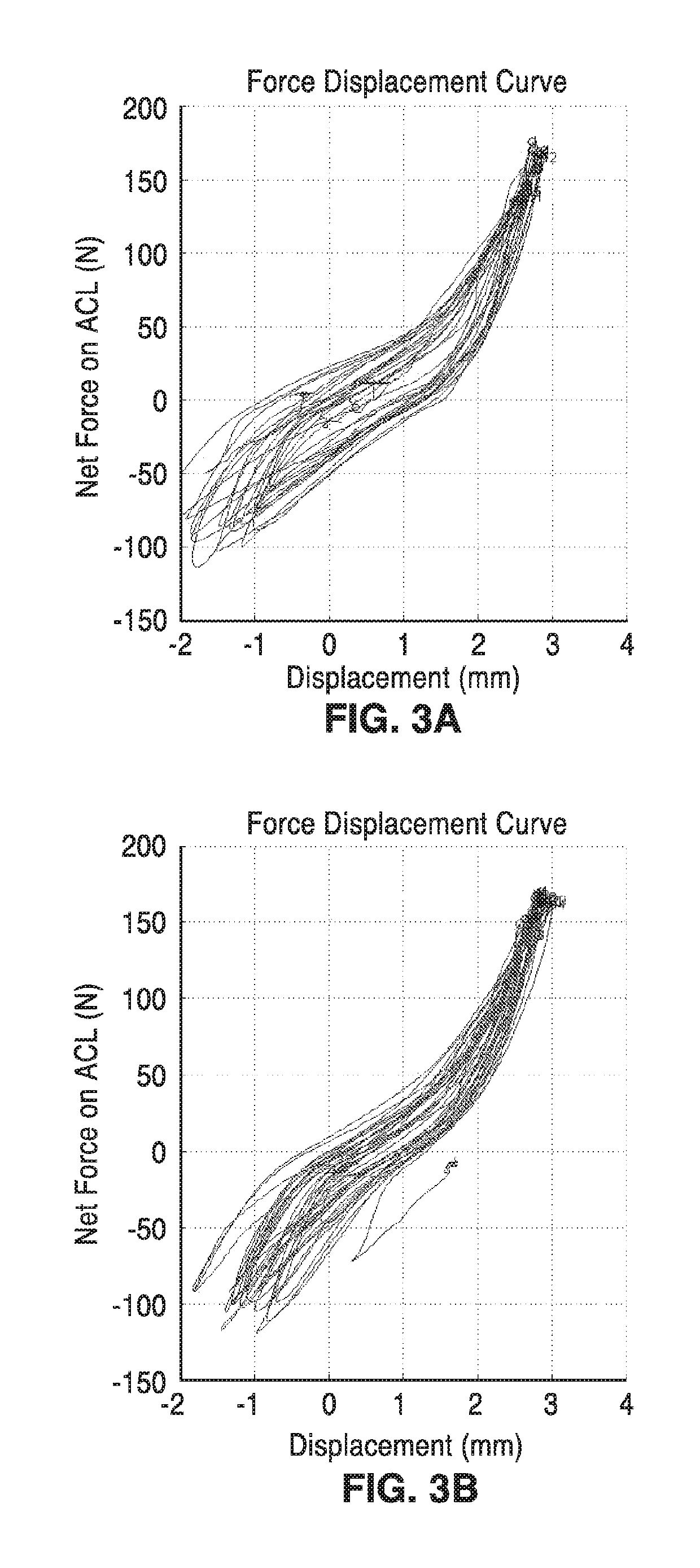 Diagnostic knee arthrometer for detecting ACL structural changes