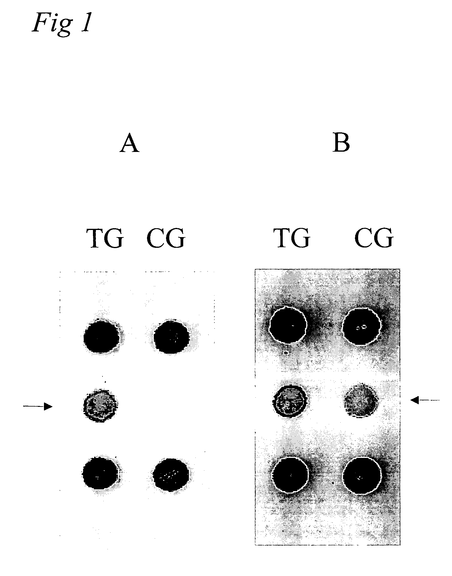Method and nucleic acids for the analysis of colon cancer