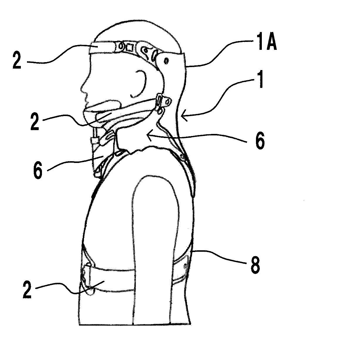 Cervical orthosis