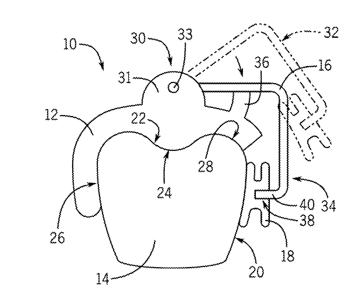 Indirect Bonding Tray and Method of Manufacture Thereof