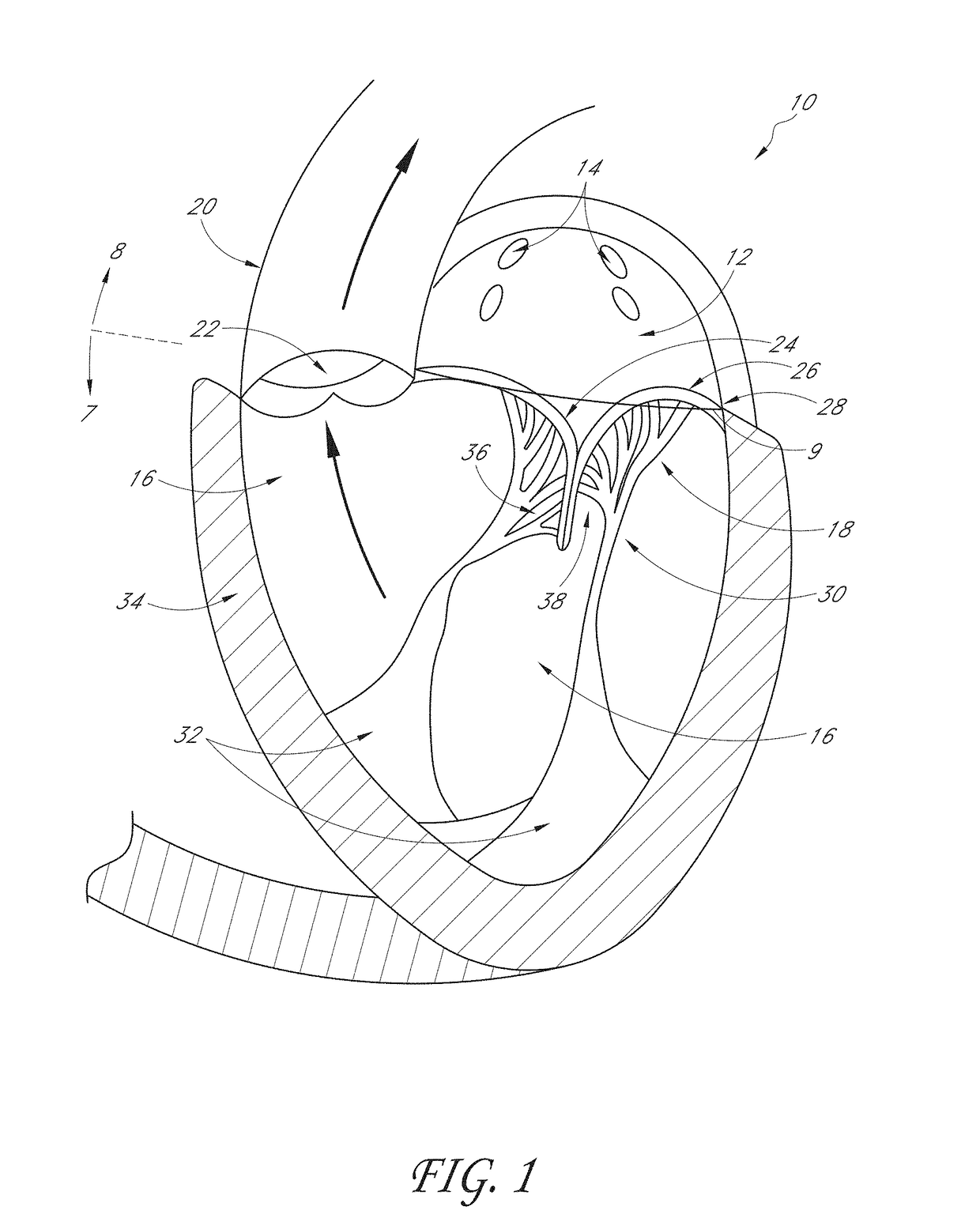 Percutaneous delivery systems for anchoring an implant in a cardiac valve annulus