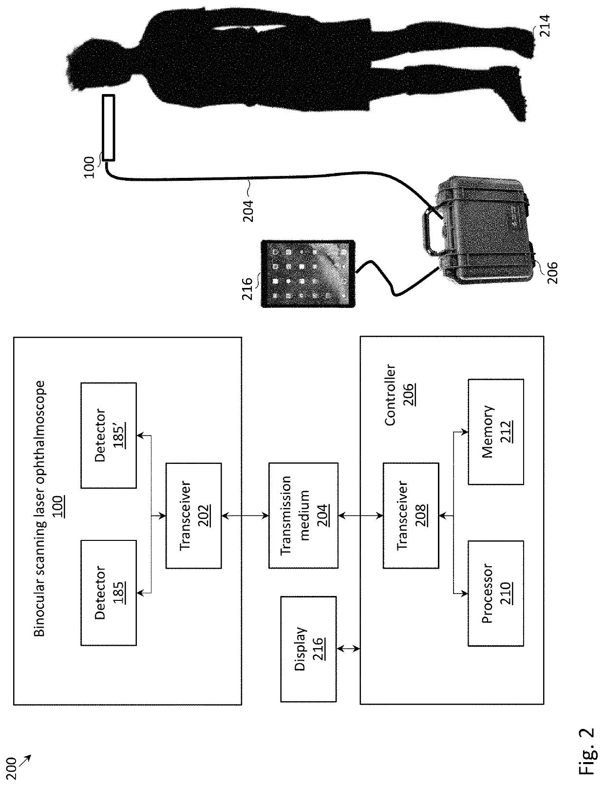 Binocular retinal imaging device, system, and method for tracking fixational eye motion