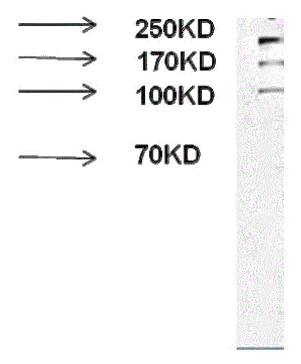 Preparation and applications of anti-Och1 monoclonal antibody