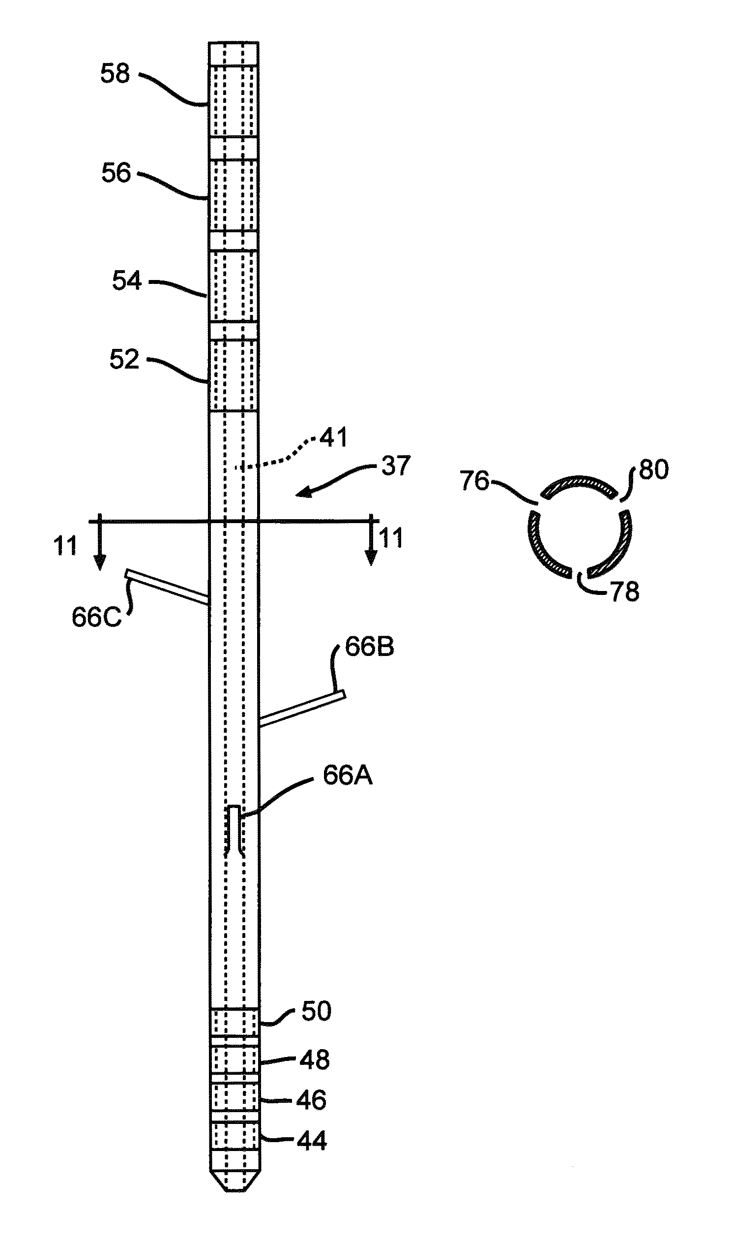 Minimally invasive methods for implanting a sacral stimulation lead