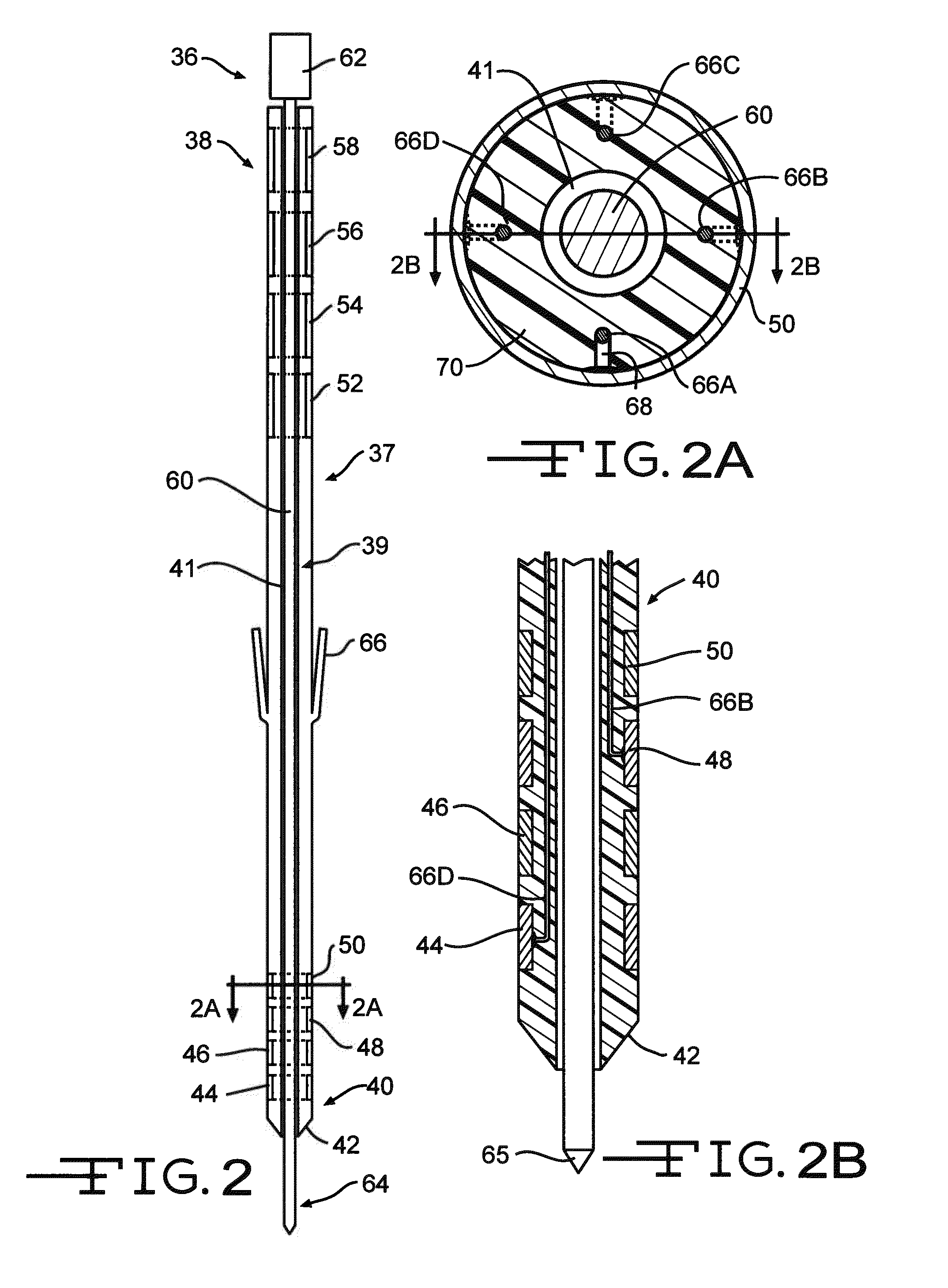 Minimally invasive methods for implanting a sacral stimulation lead